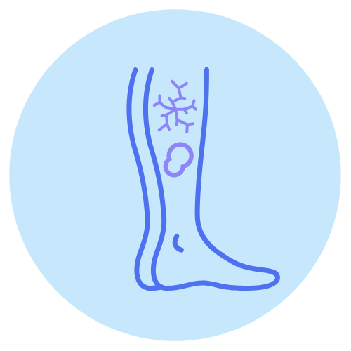 ulcers