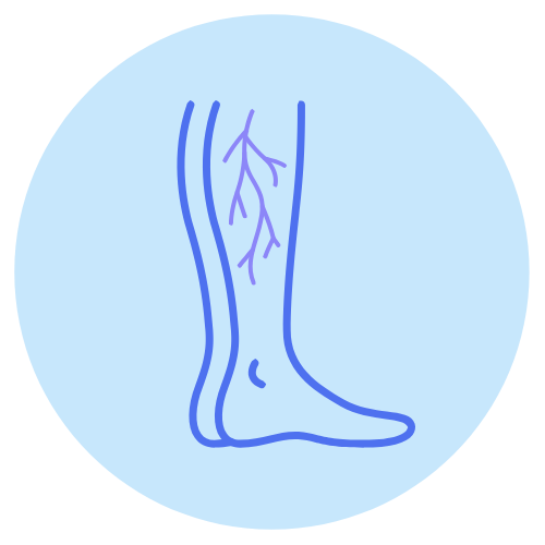 varicose and spider veins